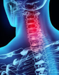 3D illustration x-ray neck painful, medical concept.